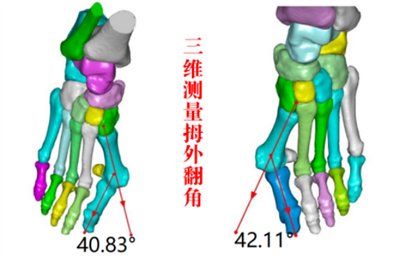 3d“导航”，精雕细琢“脚拐”归位1762.png