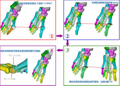 3d“导航”，精雕细琢“脚拐”归位1812.png