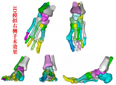 3d“导航”，精雕细琢“脚拐”归位1835.png