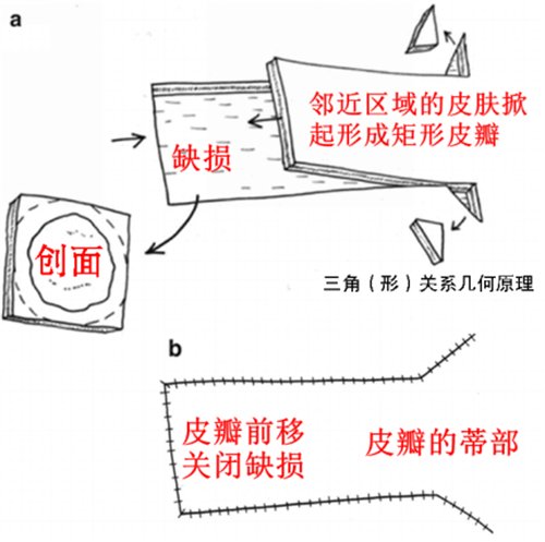 前额溃烂“巧修补” 百岁老人“焕新颜”1333.png