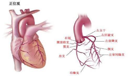 心脏血管3D效果图.png